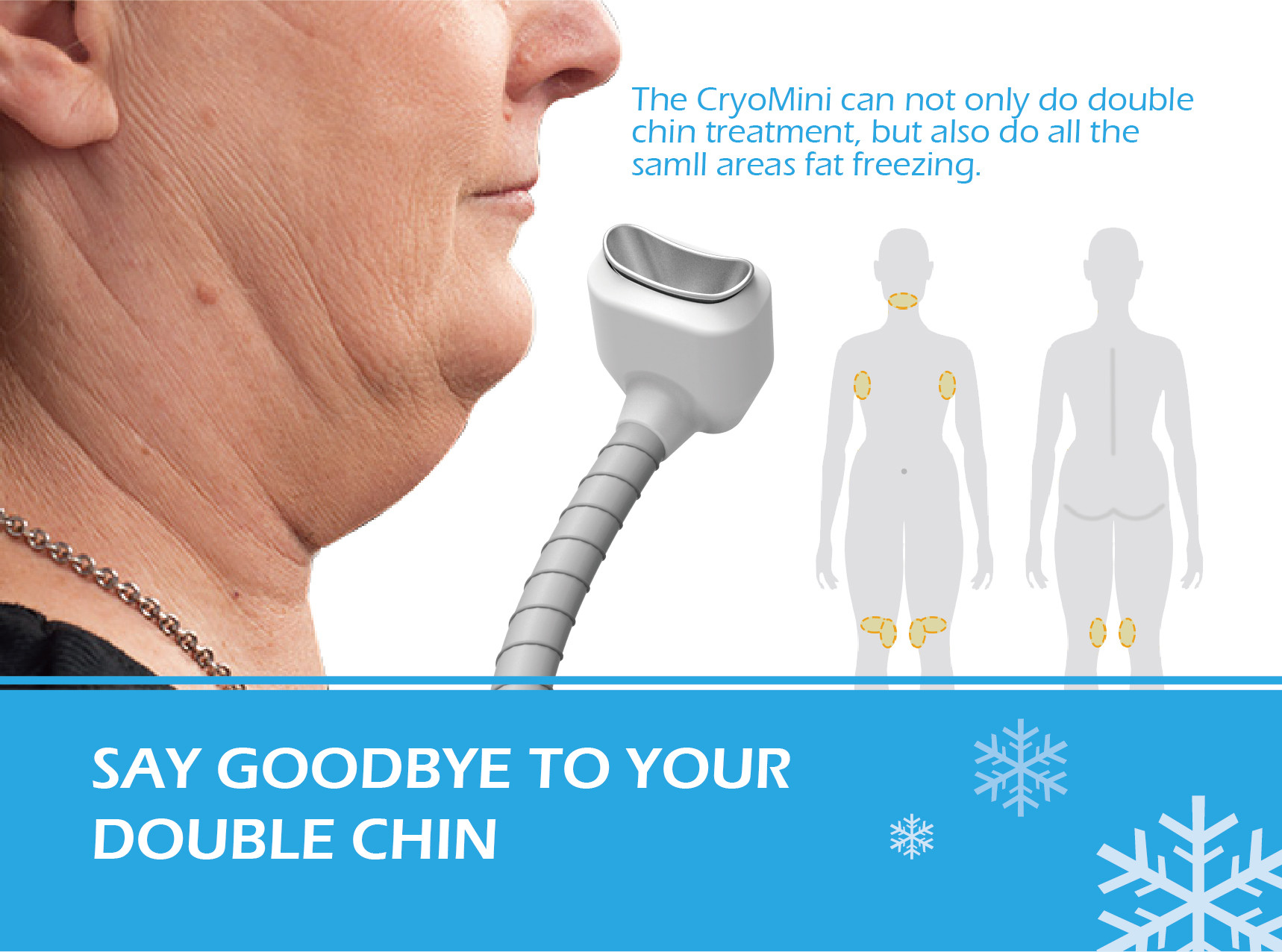 cryotherapy and weight loss unique double chin treatment cryolipolysis cellulite reduce machine
