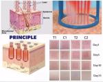 Vaginal Tightening Laser / Skin Resurfacing CO2 Fractional Laser Machine