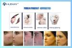 Multifunction medical laser co2 fractional/fractional co2 laser/co2 fractional