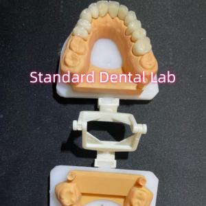 China Dental Restorative Dentistry Oral Care Full Zirconia Crown Customized wholesale