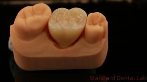 China Mill and Centring Full Zirconia Crown , China Dental Lab Fast Delivery wholesale