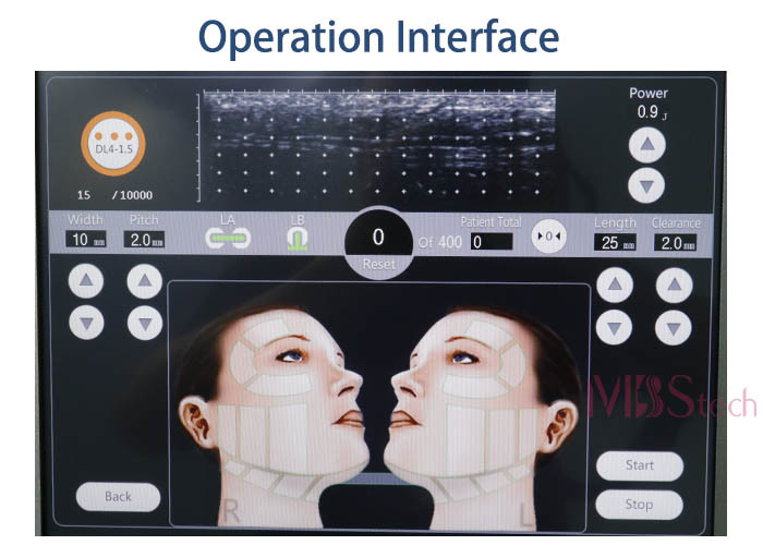 Korea 11 Lines Anti Aging Ultrasound 3D HIFU RF Machine