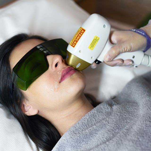 755nm 808nm 1064nm Diode Laser FDA Approved 808 Diode Laser Hair Removal