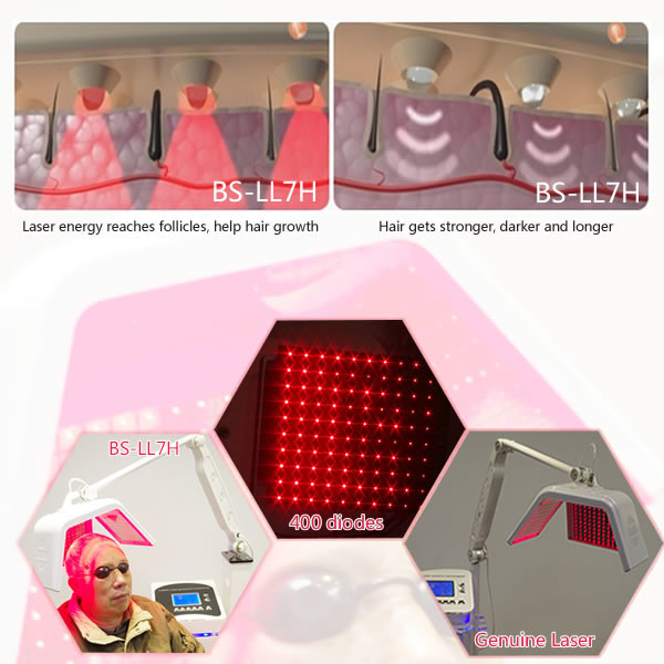 Laser hair regrowth equipment diode laser hair regrowth hair loss treatment laser machine