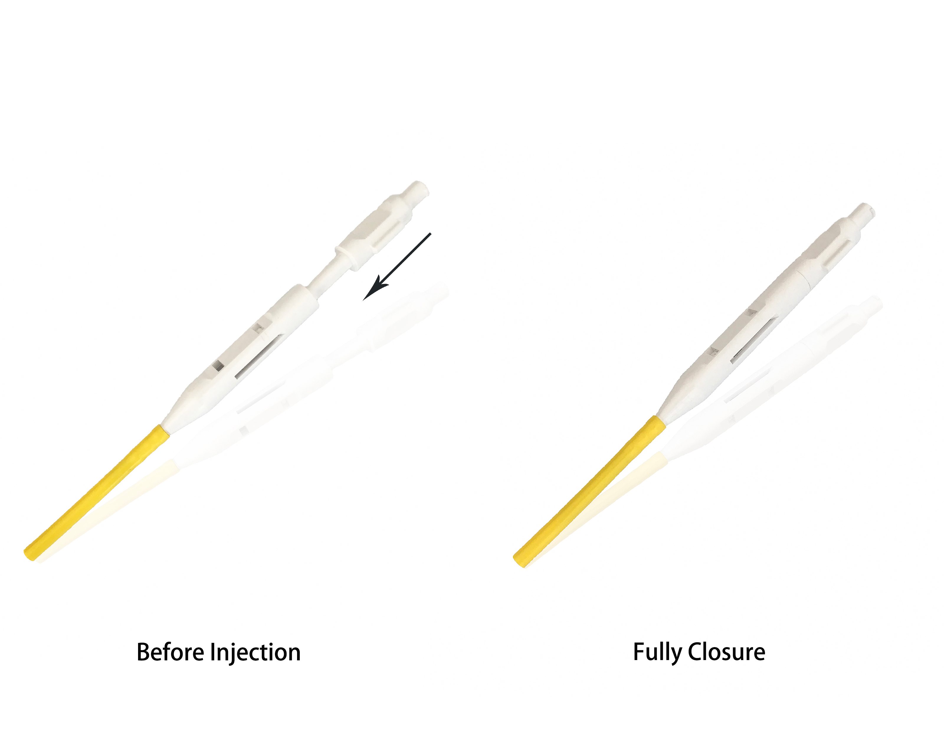 Endoscopy Medical Disposable Injection Needle with High Quality