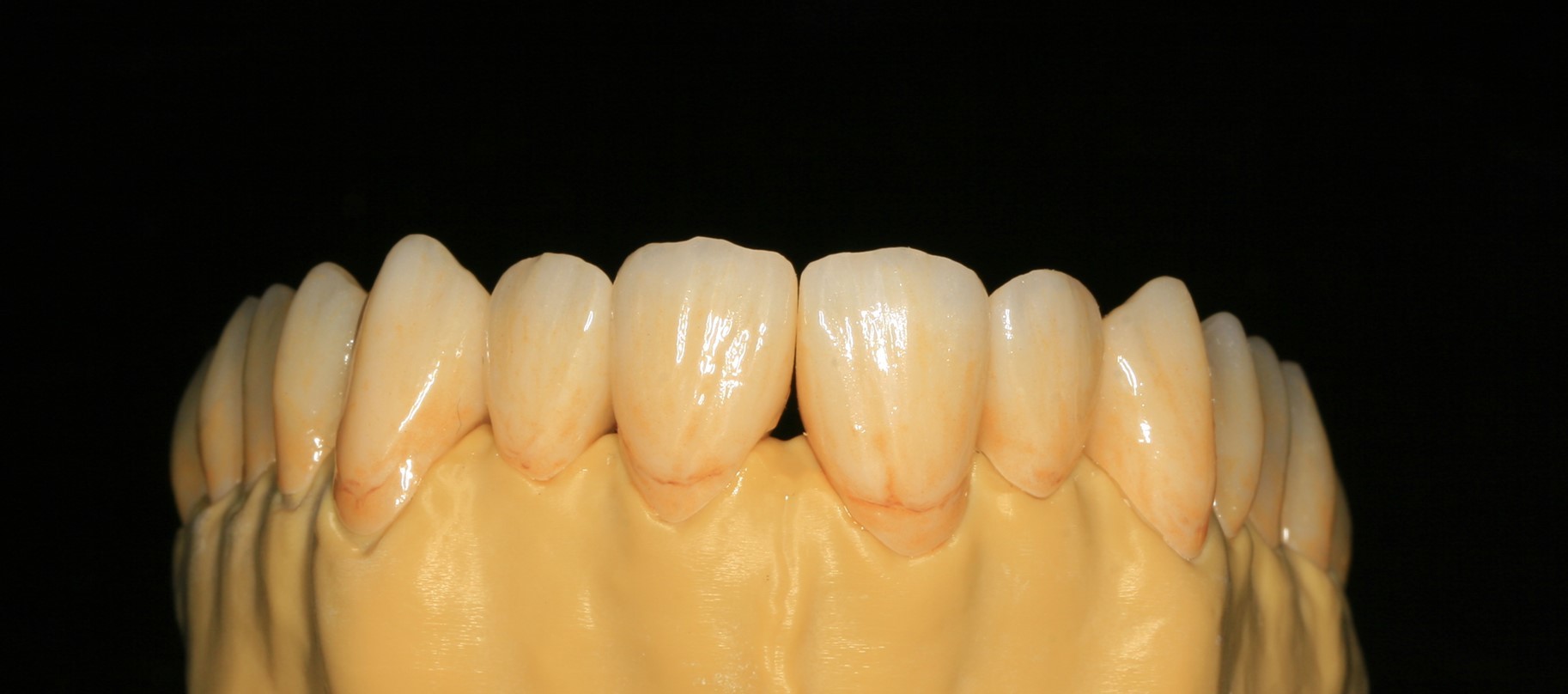 Great Biocompatibility Full Contour Zirconia Dental Crown For Dental Laboratory
