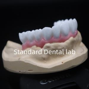 China High Esthetics White Dental Crown Diagnostic Wax Up Customized China Dental Lab wholesale