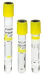 Blood Collection Tube 2ml-8ml Yellow Cap Gel Clot Activator Tube For Blood