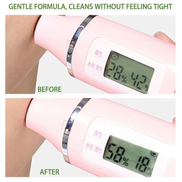 Wholesale 100g Tea Tree Pore-Purifying Blackhead Deep Cleansing Balm Acne and Blemishes Facial Remover Makeup Cream