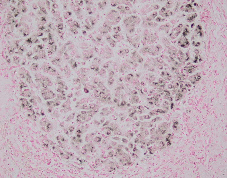 Copper Stain Kit Rubeanic Acid Method For Research Institution