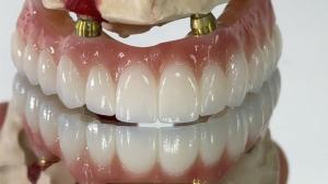 China Dental All On X Implant PFM Crown Titanium Fixed Hybrid Denture wholesale