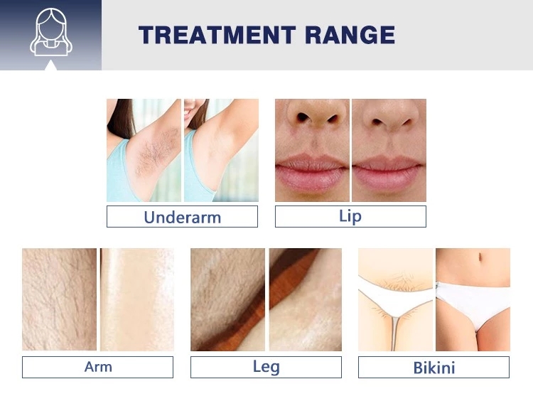High Power 808nm Germany Diode Laser Hair Removal Beauty Machine Device