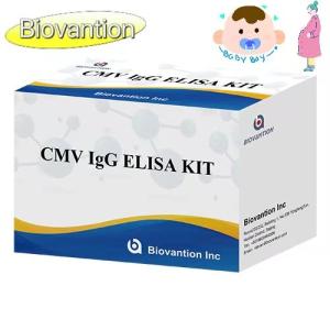 China CMV IgG ELISA Kit Pregnant Women Preventive Test High Accuracy wholesale