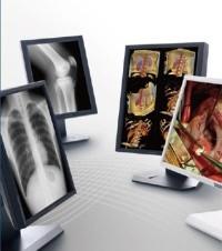 China Clear picture Medical Grade Displays , 5MP Gray Scale Medical Display wholesale