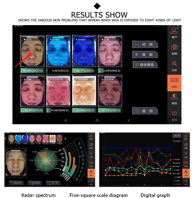 New acial quartus nls 3d gold detecto beauty machine test 3d portable facial skin scanner analyzer of moisture