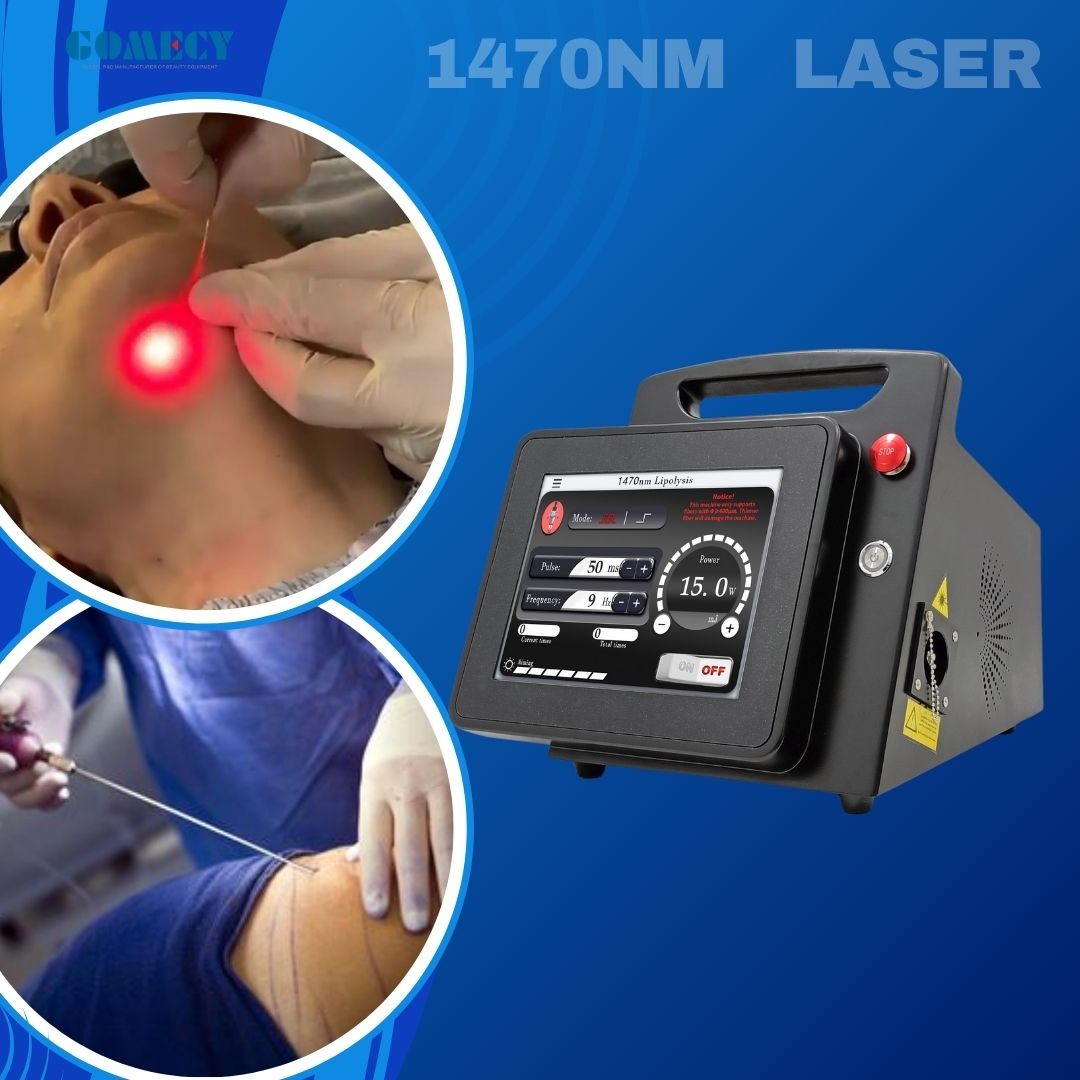 1470nm Endolaser Machine 980nm Face Lifting Laser Lipolysis Liposuction Machine 3 Meters Fiber Length