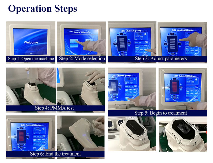 MJH0 Ultrasound Face Lift Machine 3D Anti Wrinkle Skin Tightening Mejire Band