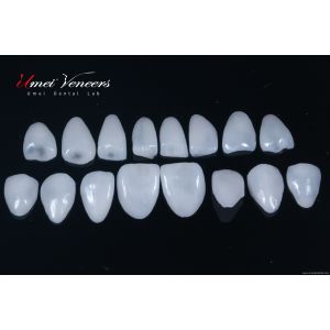 China Strong zirconia dental veneers wholesale