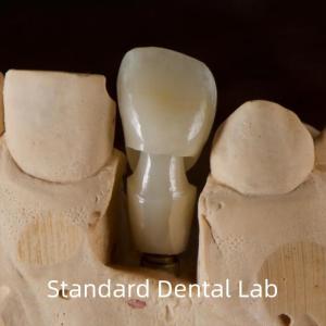 China Dental Implant Tibase Zirconia Abutment Titanium Accuracy Customized wholesale