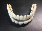 Denture Repair Dental Acrylic Resin Teeth Kit Artificial Synthetic Resin