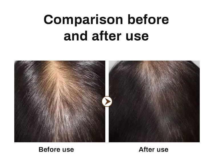 300 ML Private Label Oil Control Natural Plant Hair Growth Anti Hair Loss Shampoo