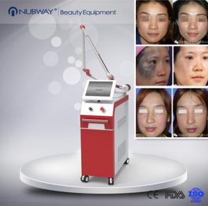 China Best effect! 1064nm Q Switched Nd Yag Laser Machine :Pigment removal,Tattoo removal,Skin rejuvenation.Hair removal wholesale