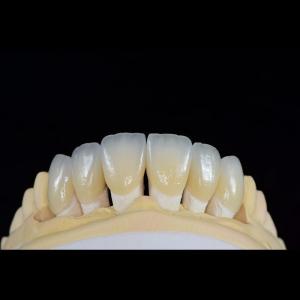 China Dental Lab Teeth Feldspathic Porcelain Veneers Custom Shaped wholesale
