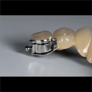 China Aesthetic Precision Dental Implant Ball Attachment Partial Dentures wholesale