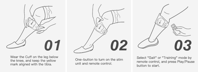 16-33 Hz Foot Drop Stimulator Small And Compact With Gait And Training Mode