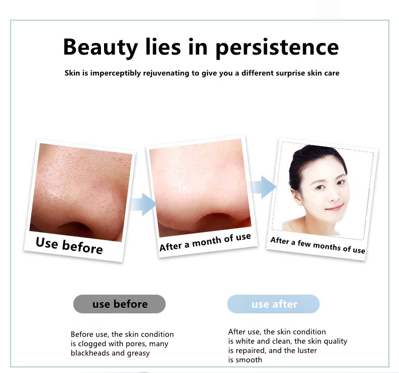 Electric Galvanic Ultrasonic Skin Cleanser Rechargeable