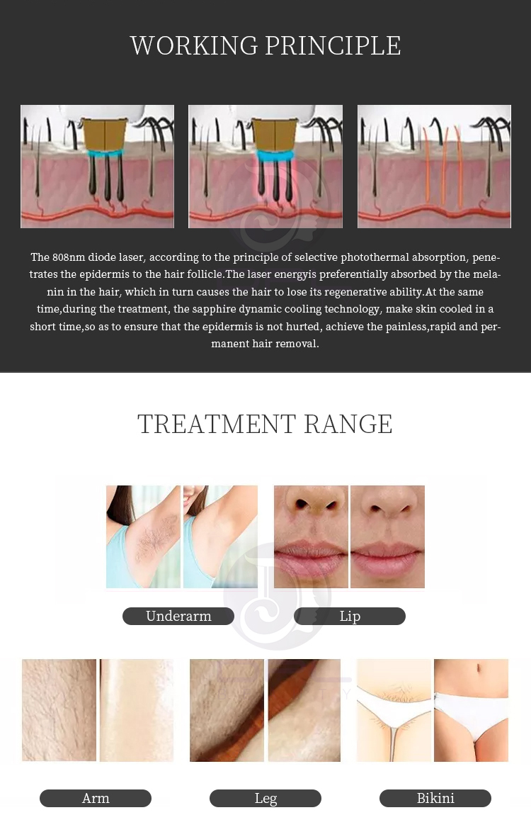 Permanent diode laser depilation hair removal machine diode yag painfree for laser hair removal