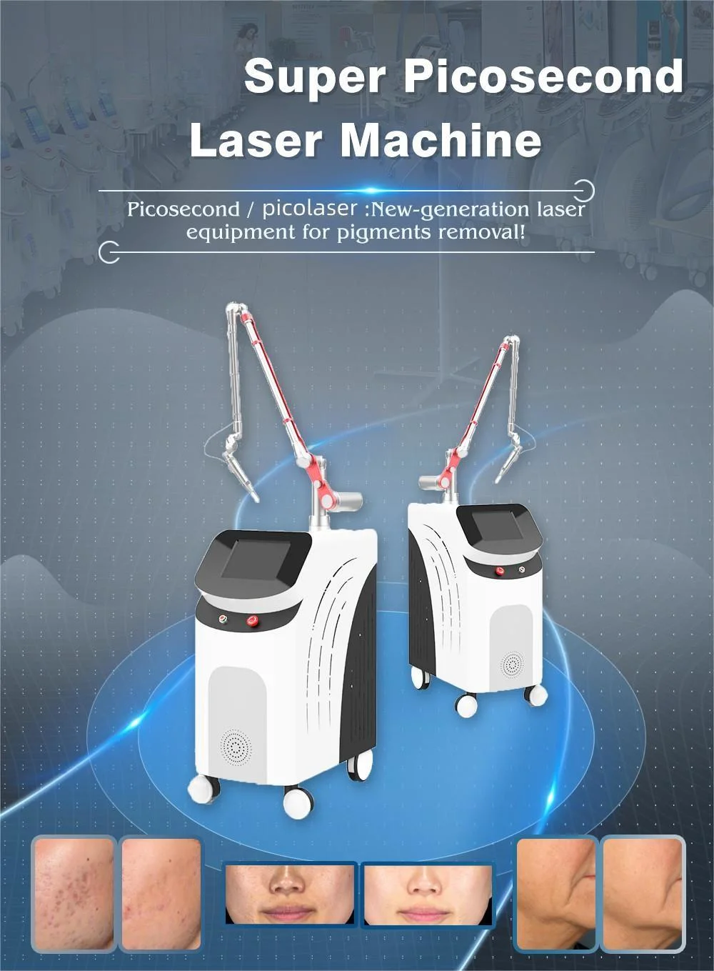 2023 Picosecond Pico Laser Tattoo Removal Machine 1064 532nm Q-Switched ND YAG