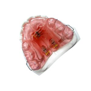 China High Hardness FDA Functional Appliance Orthodontic Rubber Retainer wholesale