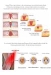 Muscle Message 635nm 660nm 850nm LED Red Light Therapy Beds For Chiropractic Use