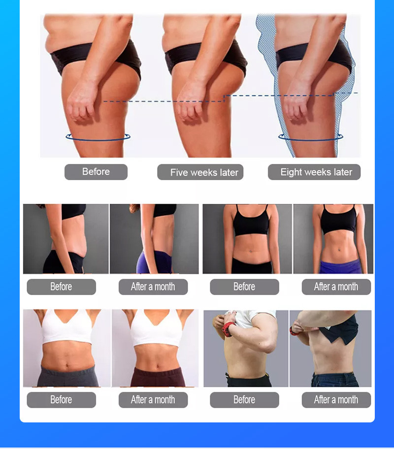 Hi Cryo Sculpting Machine , Electro Muscle Stimulator Cryo Fat Freezing Machine