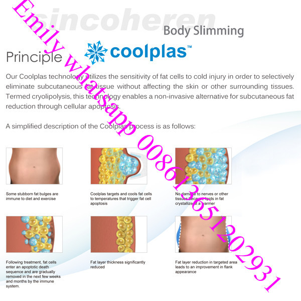 slimming machine Coolplas cryolipolysis fat freezing liposuction sincoheren