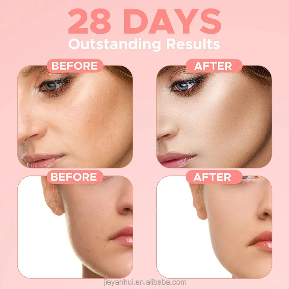 New Skin Care Serum Facial 4 in 1 Whitening Anti Age Face Serum with Vitamin and Niacinamide Facial Serum