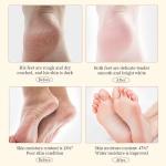 Chamomile Extract Hand Crack Cream Dryness Crackness Feet Moisturizing Cream