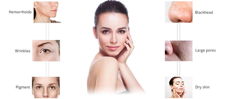 GOMECY skin analyzerskin care machine  beauty equipment for facial skin analysis