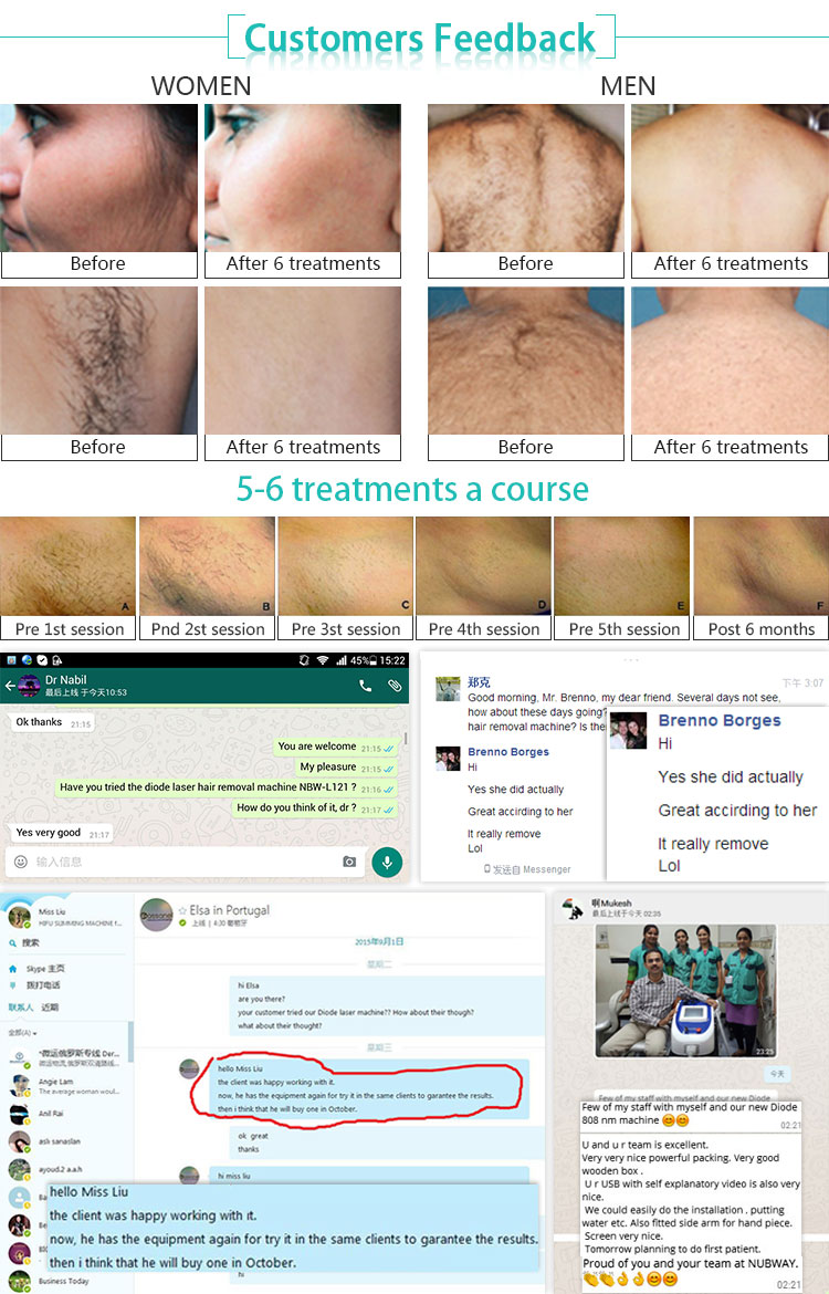 CE Approved 2018 new permanent 808nm hair removal diode laser 