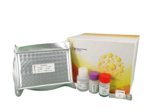 China Immunoglobulin Iga Elisa Kit , High Precision / Sensitive Immunoassay Test Kits wholesale