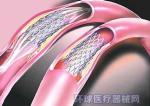 NiTi Parts Medical Wire Forming , OEM Manufacturing Custom Metal Forming