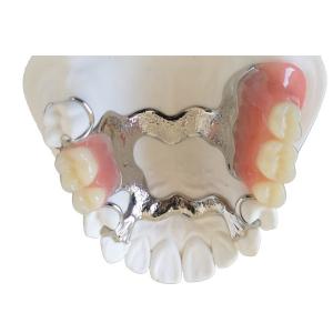China OEM 3D Printer PFM Dental Crown Bridge High Biological Intermiscibility wholesale