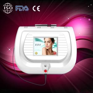 China 30Mhz Spider Vein Removal Machine For Red Blood Silk Treatment with best effect 220V/110V wholesale