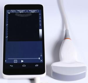 China 128 Elements Power Probe Pocket Ultrasound Scanner Machine 64GB wholesale