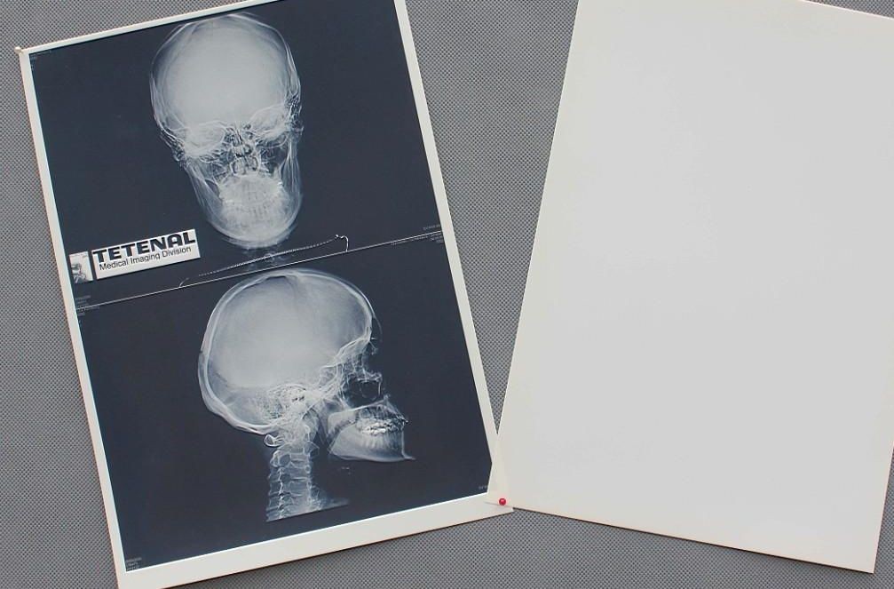 High Sharpness Xray Paper Films , Agfa Dt2b Fuji Medical Thermal Films