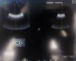 GE RAB6-D 4D Ultrasound Transducer Repair Cardiovascular Ultrasound Machine