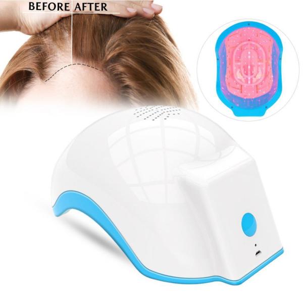 Hair Loss Hair Growth Device Protect Scalp Diode Laser LED Light Treatment