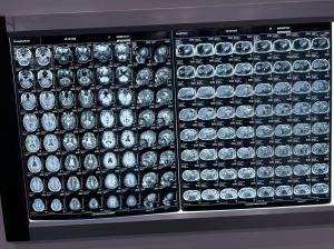 China Automatic Density X Ray Film For Medical Equipment wholesale
