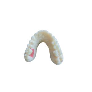 China Digital Oral Scanning PFM Dental Crowns Bridge Implantology Demands wholesale